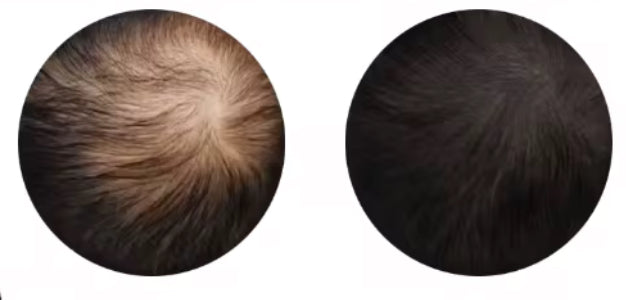 brosse massante stimulateur de pousse